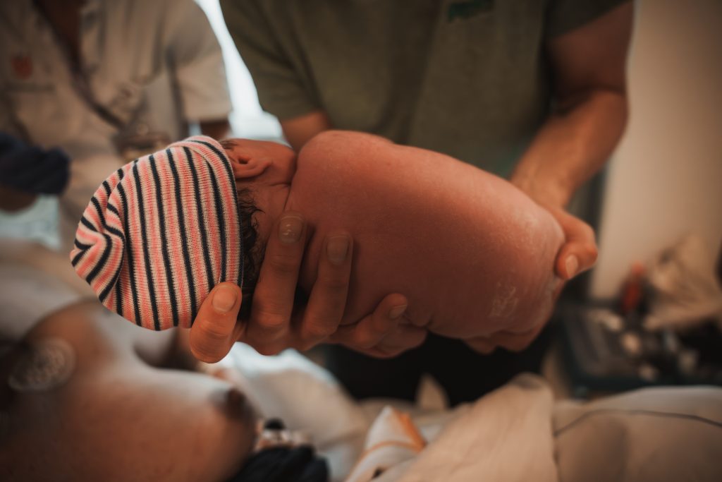 Newborn baby in striped hat being gently cradled in parent's hands moments after birth